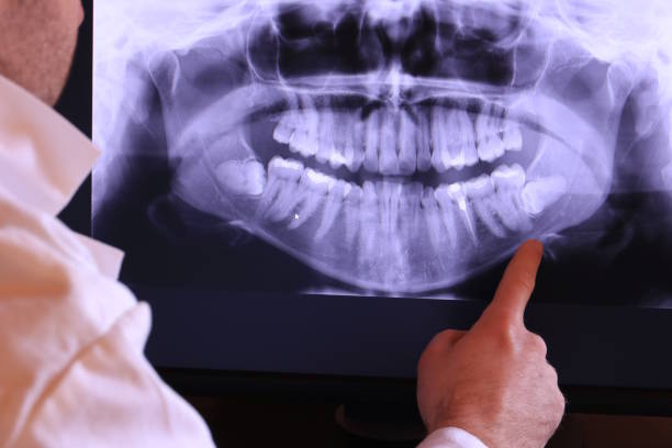 Best Knocked-Out Tooth Emergency  in Plainsboro Center, NJ